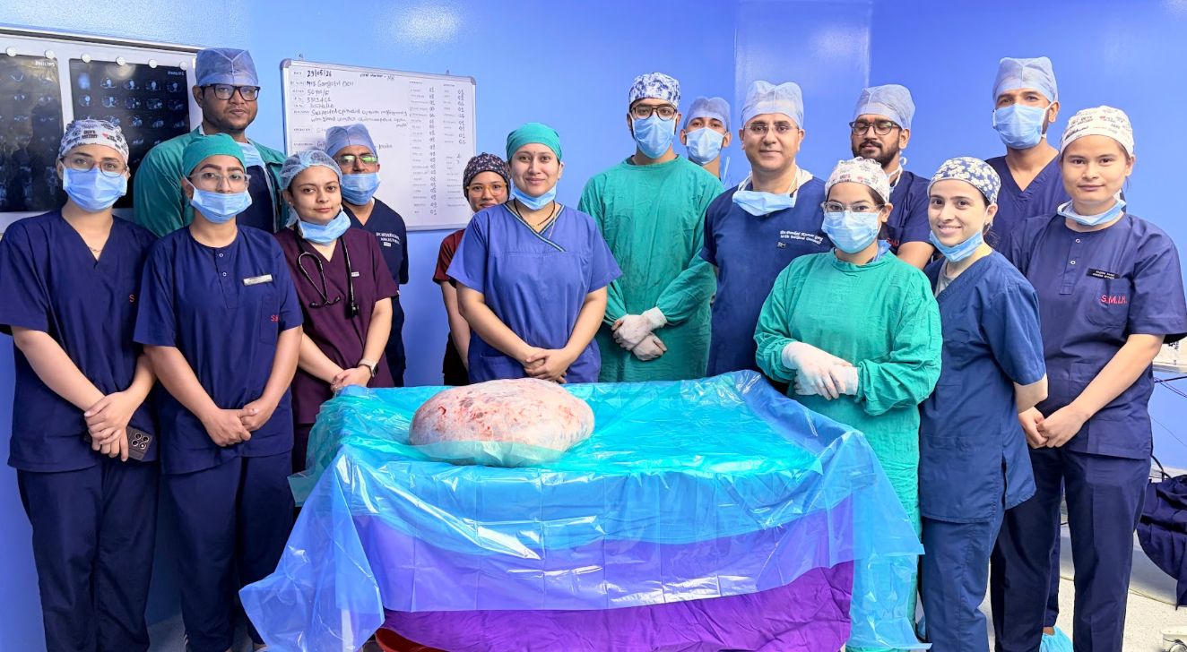 इन्दिरेश अस्पताल के कैंसर सर्जनों की बड़ी सफलता, 15 किलो की गाँठ बनी चुनौती, ऑपरेशन रहा सफल